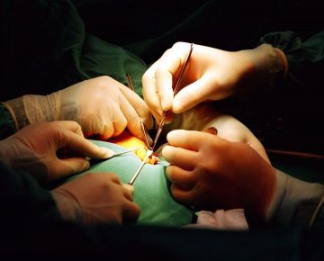 本院提供外科系手術、麻醉科術後止痛 說明影片介紹,歡迎點閱